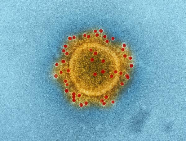 Imagem tirada por um microscópico eletrónico do coronavírus da MERS